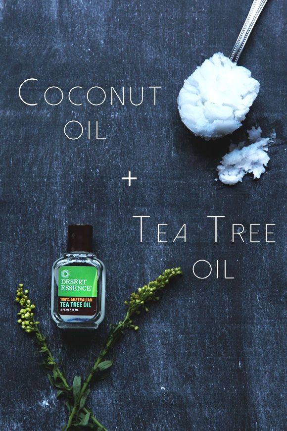 Best dandruff solution: tea tree oil or coconut oil?