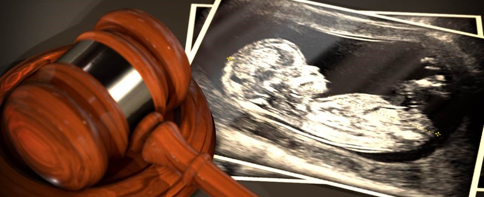 Should abortion be legal up to full term?