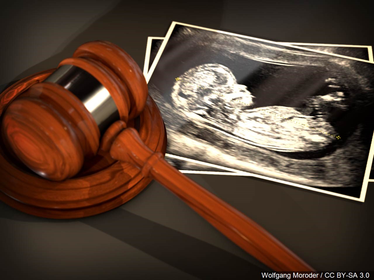Should abortion be legal up to full term?