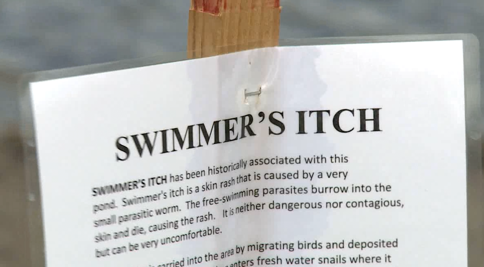 Do warnings about swimmer's itch keep you out of alpine lakes?
