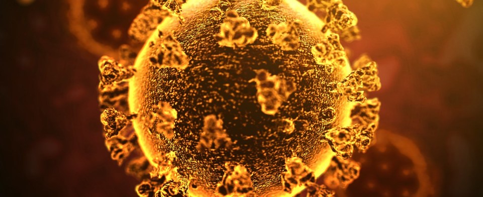 What do you want to happen with restrictions?