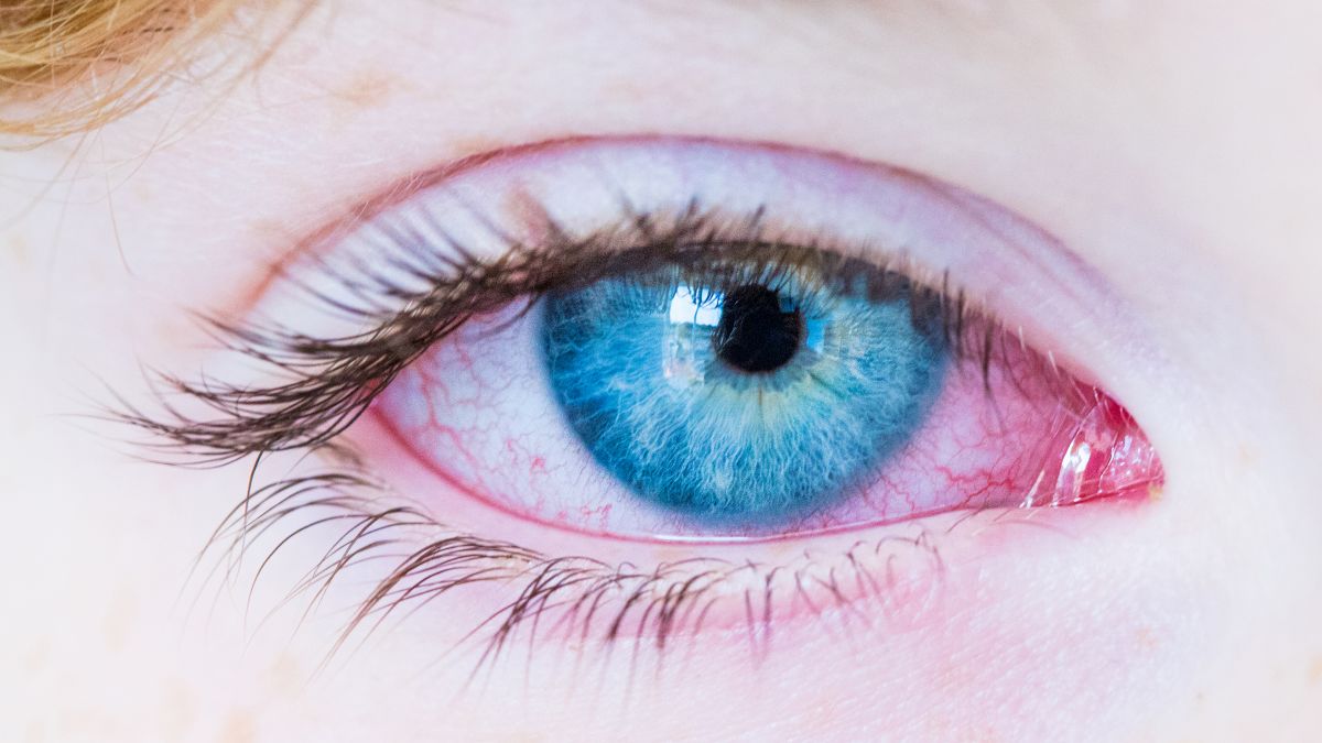 Do you fear your child may develop Kawasaki disease?
