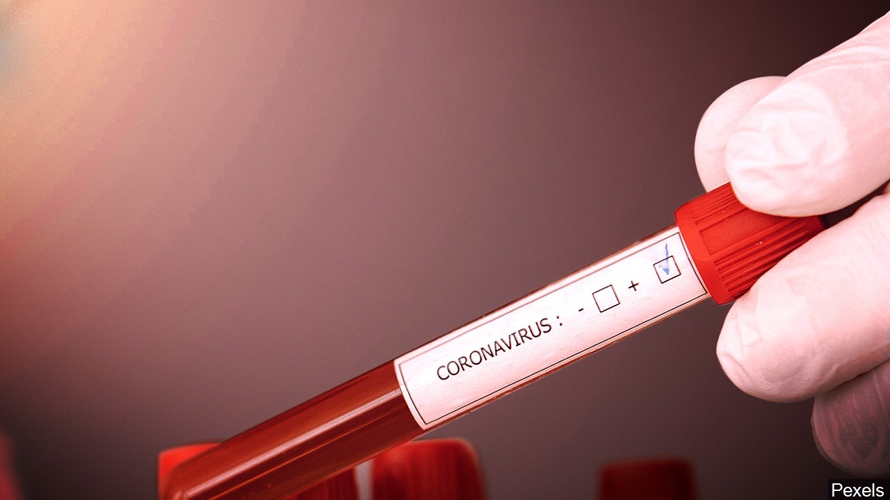 Should the U.S. slow down COVID-19 testing?