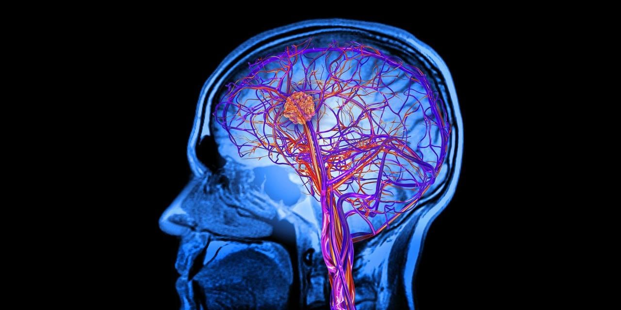 Could there be a cure for Alzheimers in the next decade?