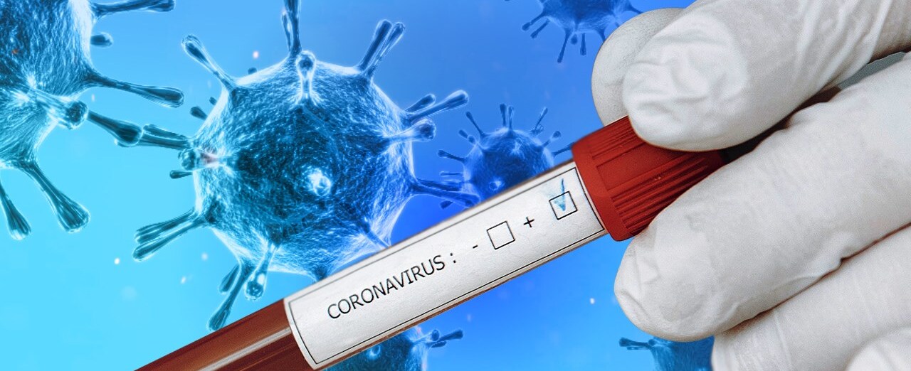 Do you believe COVID-19 testing is still required?