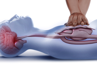 Would you take a CPR class if it were free?