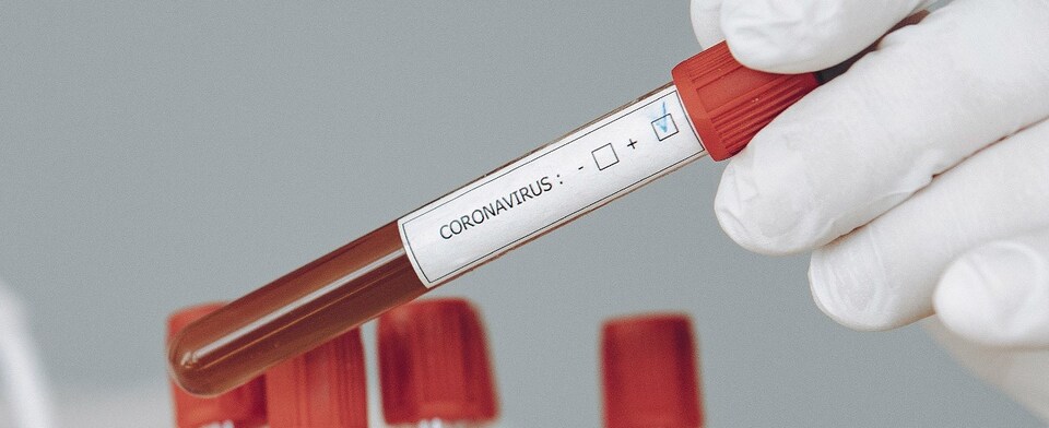 Do you think students should be tested daily for coronavirus?