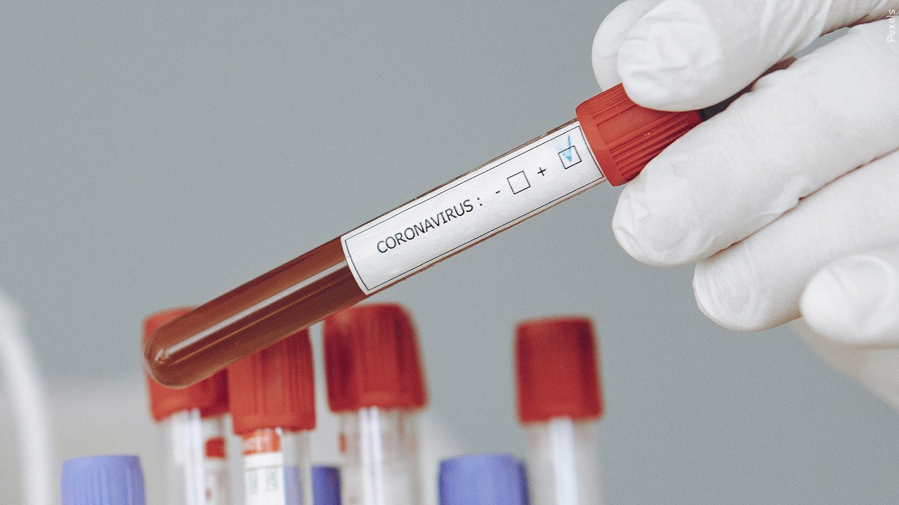Do you think students should be tested daily for coronavirus?