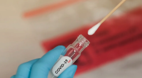 Will you take advantage of the free rapid COVID-19 test?