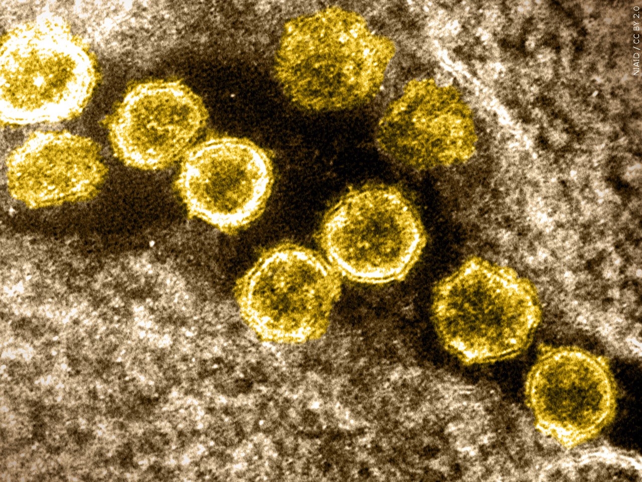 Are you concerned after omicron was found in Missouri?

