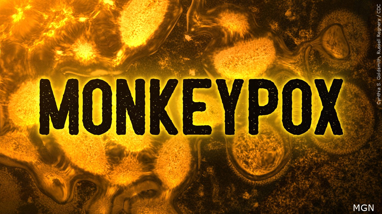 Are you concerned about Monkeypox? 