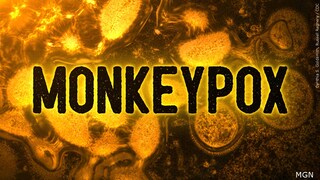 Are you concerned about Monkeypox? 