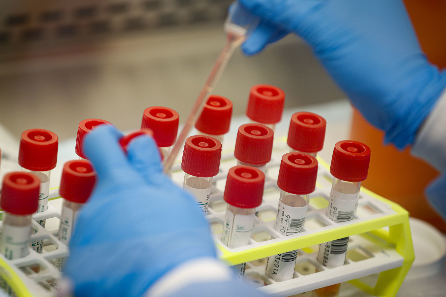 Are you still worried about COVID-19?