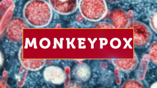 Do you think upcoming events should be canceled as Monkeypox cases grow?