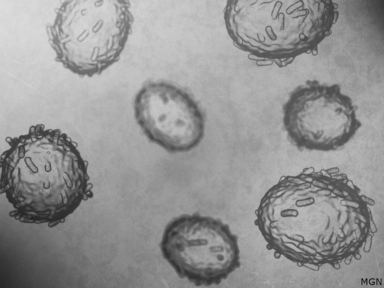 Are you more worried about monkeypox now that a local case has been found?