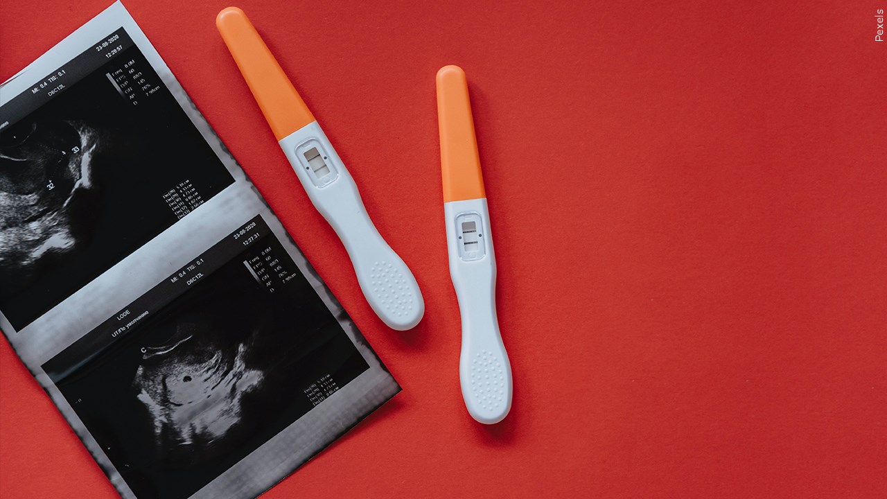 Do you think the Arizona Supreme Court will reinstate the near-total abortion ban?