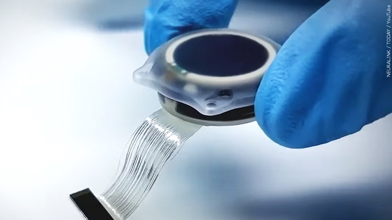 Do you think the Neuralink brain chip will be effective?