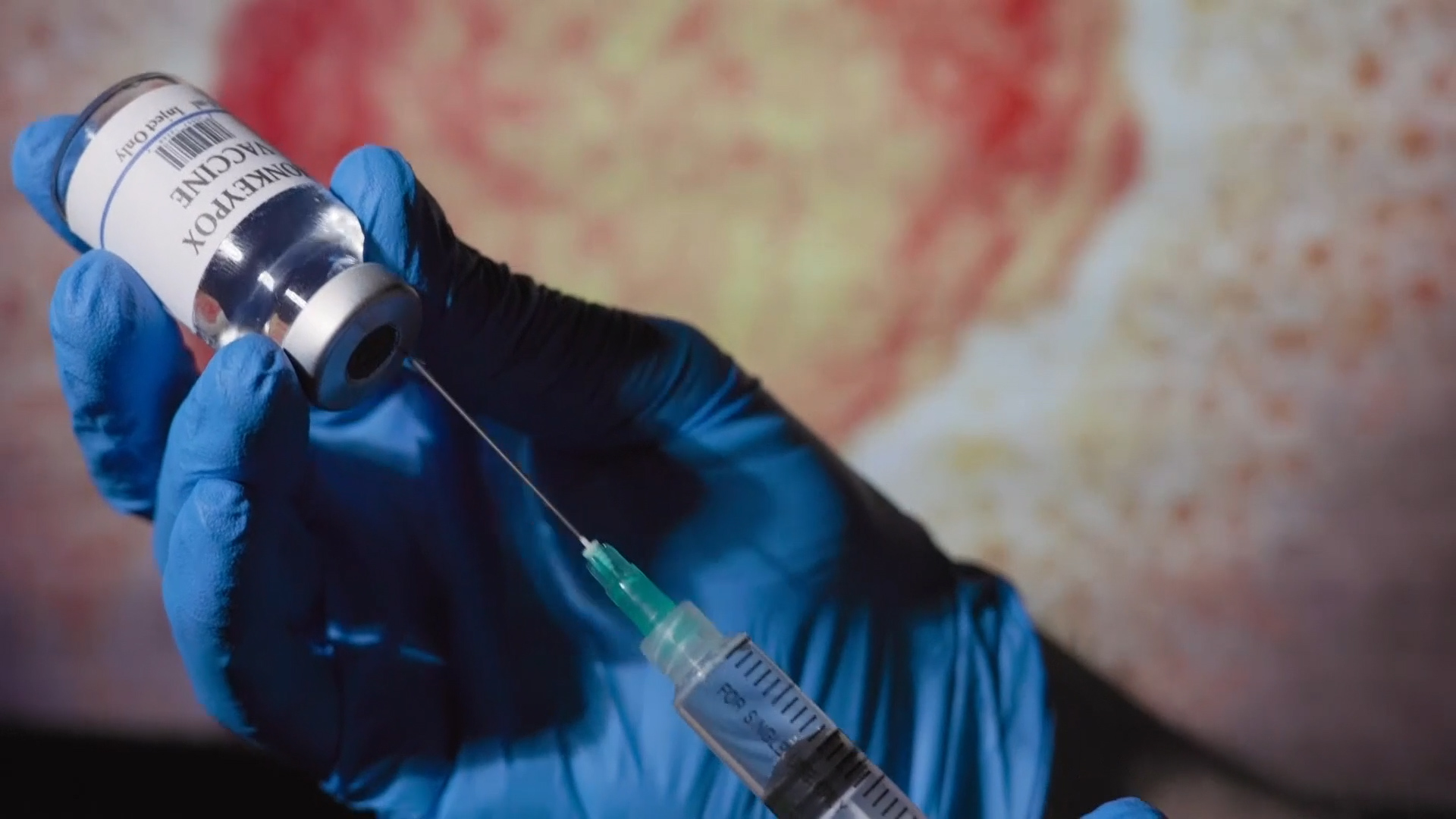 Are you vaccinated for mpox?