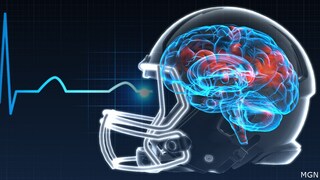 Should more be done to prevent CTE?