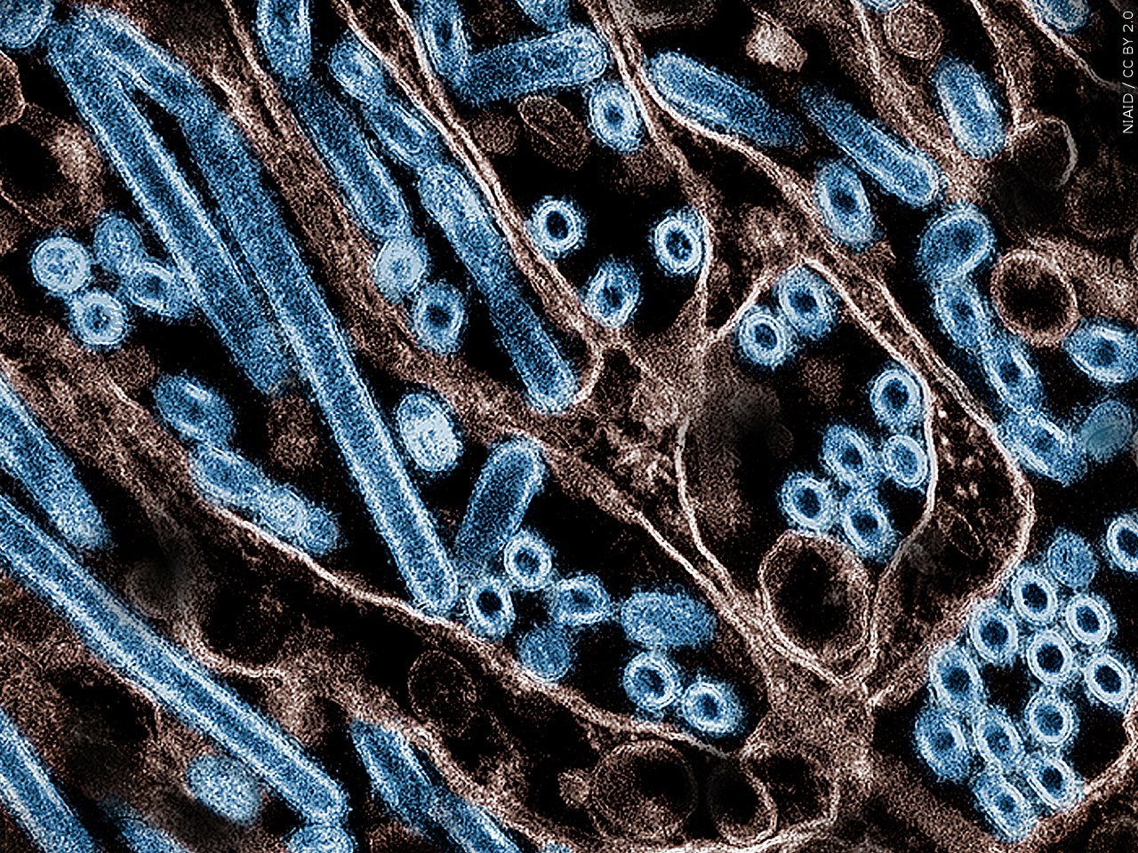 Are you worried about Bird Flu?