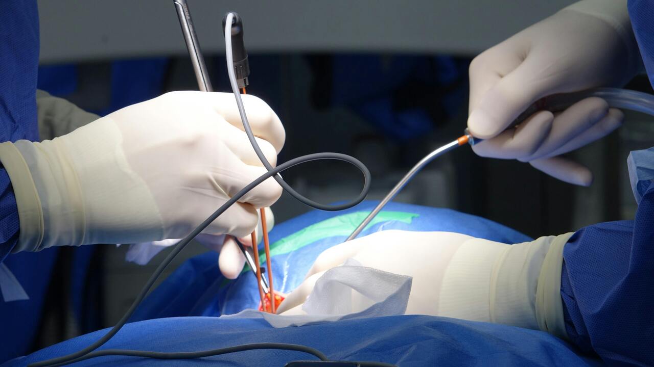Would you donate one of your organs?