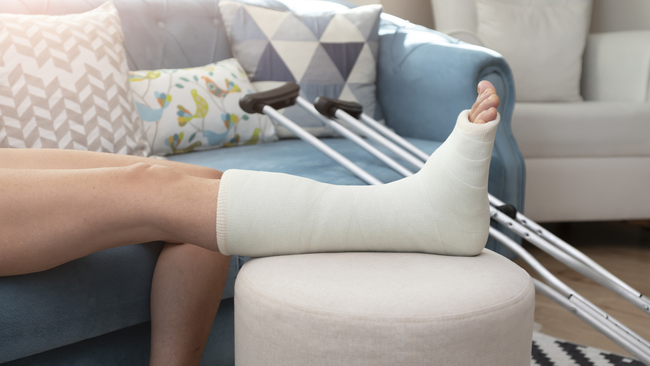 Have you ever broken a bone?