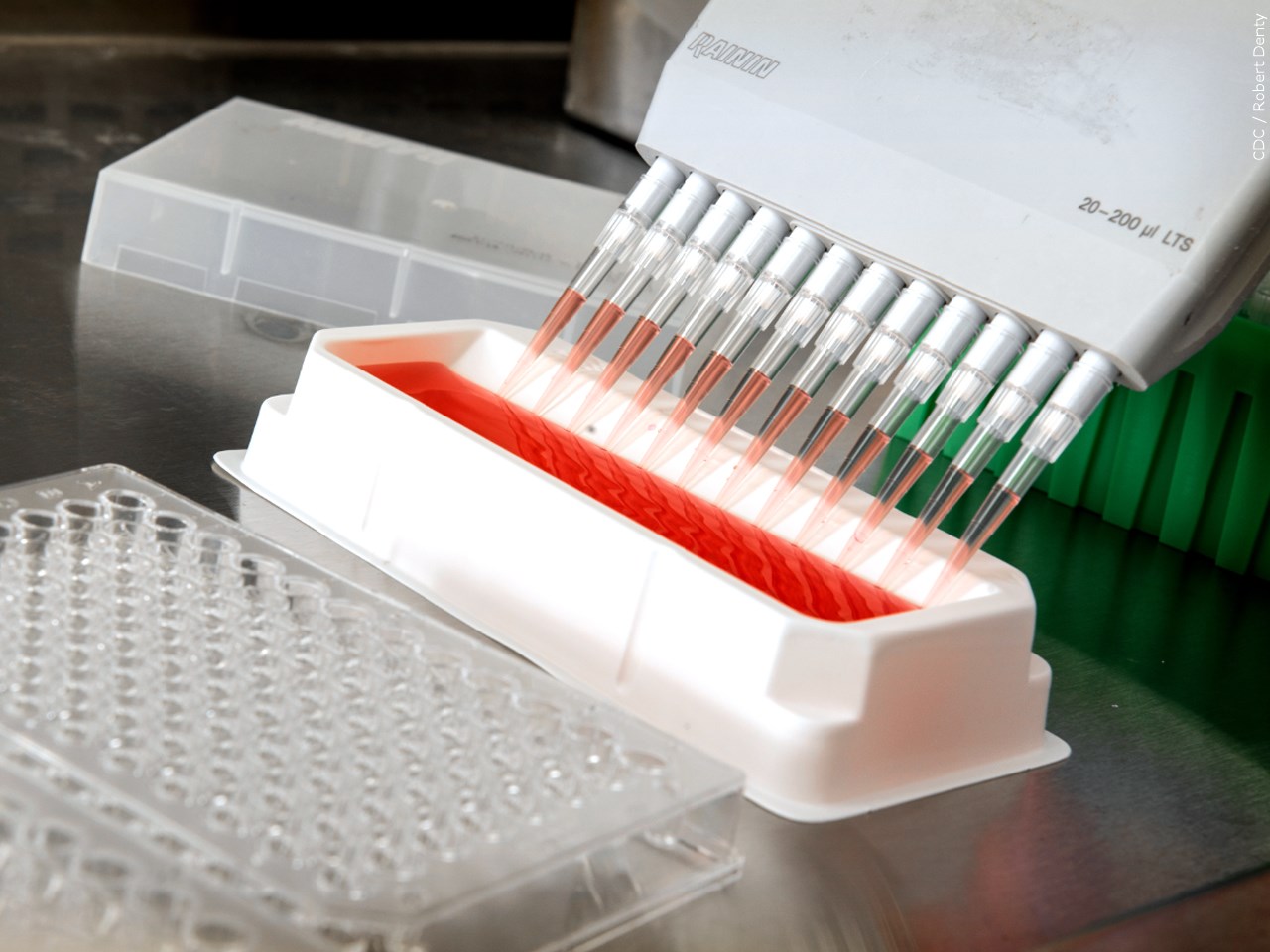 Are you interested in getting a COVID-19 antibody test?