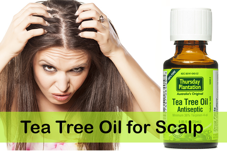 Best dandruff solution: tea tree oil or coconut oil?