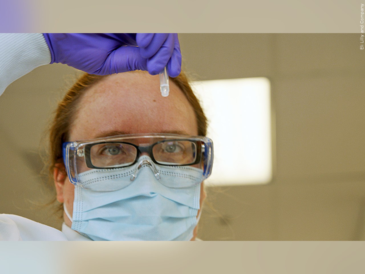 Are you interested in getting a COVID-19 antibody test?
