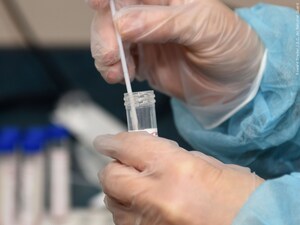 Have you had trouble getting a coronavirus test?